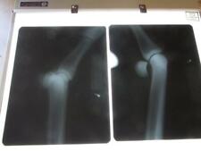 Vintage 1960s Portable X-Ray Light Antique Logan Porta View Doctor Nurse 9968