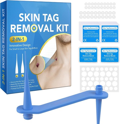Skin tag removal kit in - tag, kit,