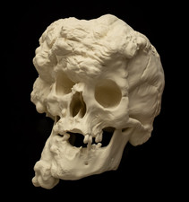 Joseph Merrick Elephant Man