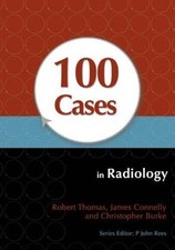 100 Cases in Radiology by 