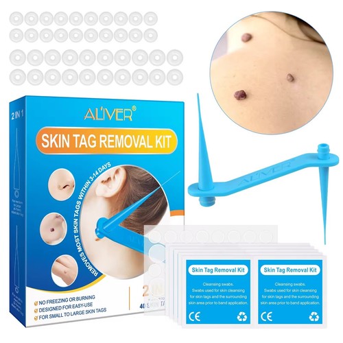 Skin tag remover kit natural - skin,
