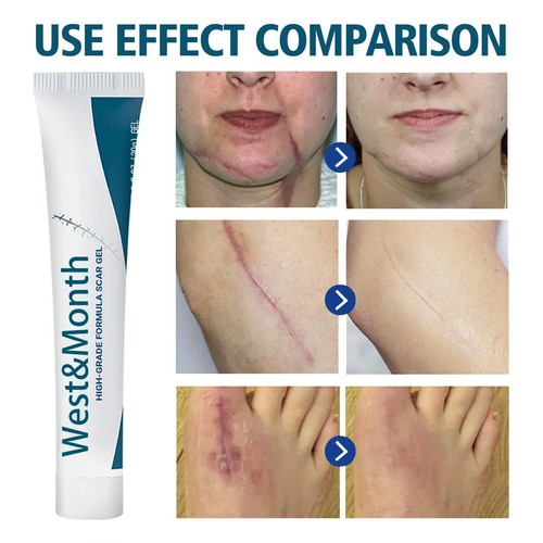 30ml useful scar removal - removal, cream