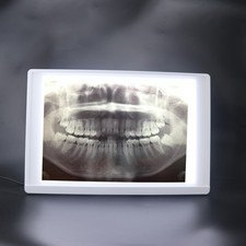Dental X-Ray Film Illuminator Light Box X-ray Viewer Light Panel Screen