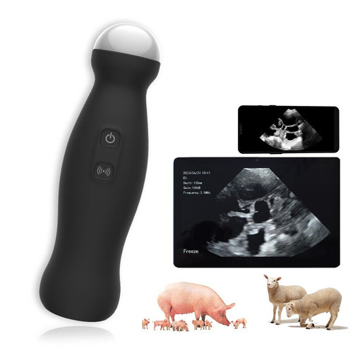 Wireless ultrasound machine - ultrasound,