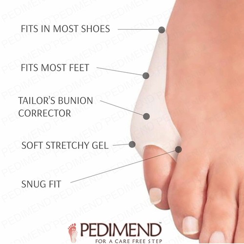 Bunionette tailors toe - bunionette,