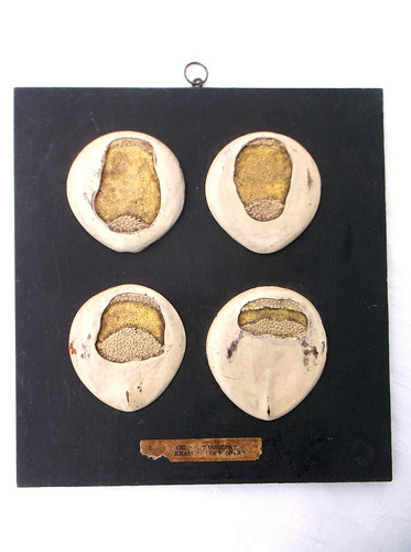 Rare antique anatomical - rare,
