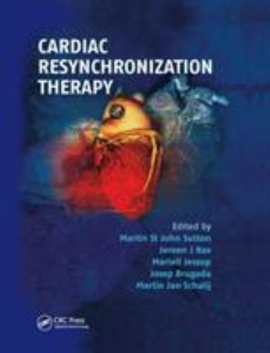 Cardiac resynchronization - cardiac,