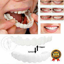 Smile Snap On False Teeth Upper & Lower Dental Veneers Dentures Tooth Cover Kit