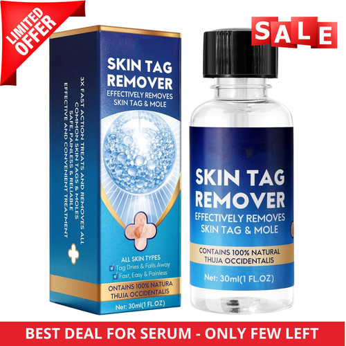 Strong skin tag - strong, remover
