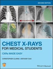 Chest X-Rays for Medical