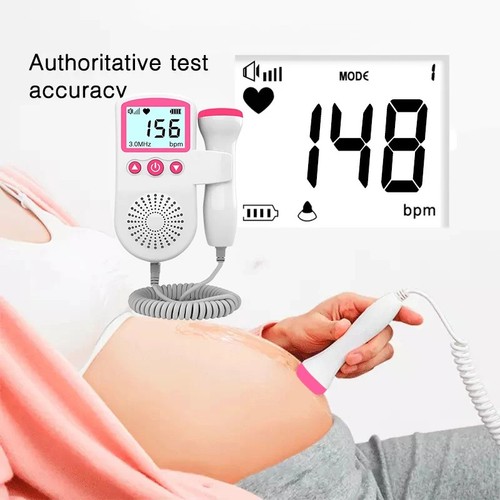 3mhz portable prenatal - 3mhz,