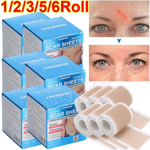 Medical grade scar sheet - 6/3x,