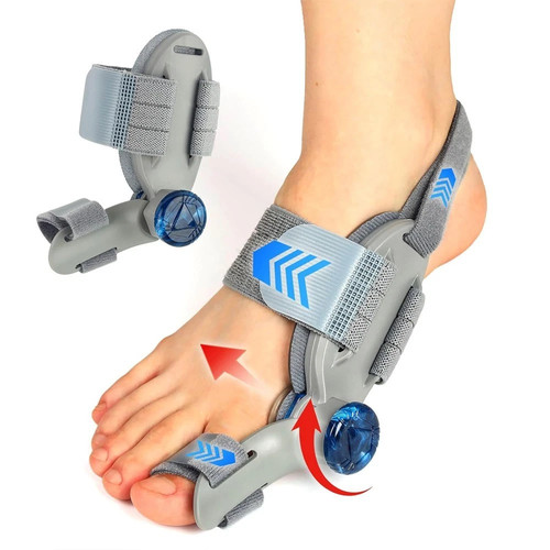 Nhs adjustable hallux - hallux, valgus