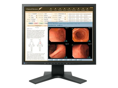 Eizo radiforce mx192 1mp - mx192, 19"