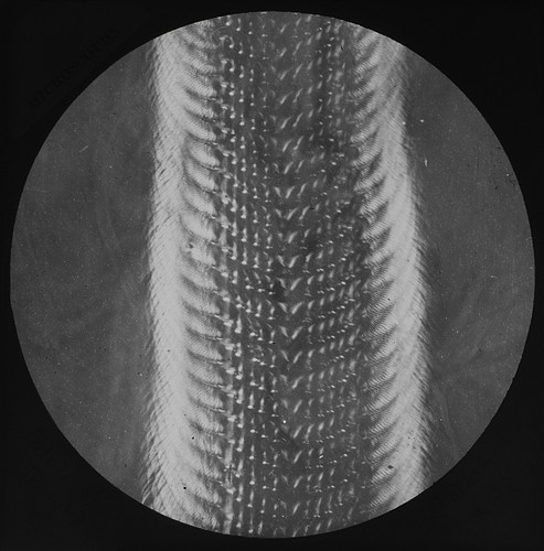 Microscope photo palate - palate, of