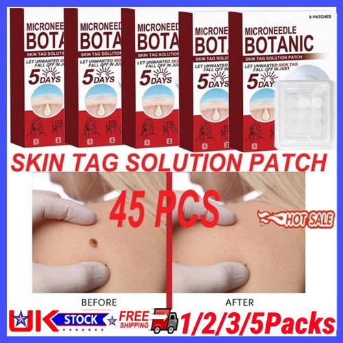 Box microneedle botanic - 1-5,