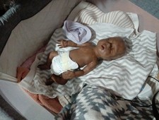 Ethnic Preemie Silicone 15