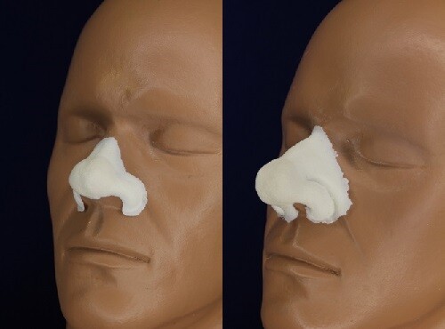 Prosthetic bulbous nose large - bulbous,
