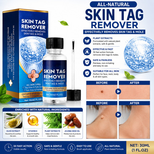 Strong skin tag remover - skin, serum