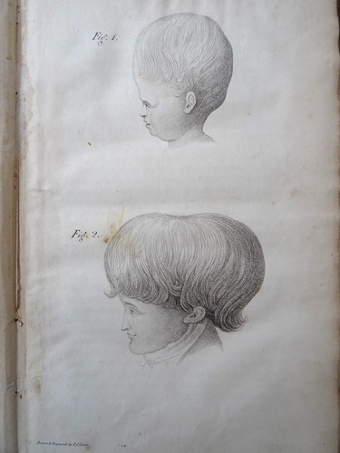 1825 phrenology doctrine - 1825,