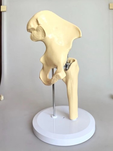 Artificial size hip joint - size,