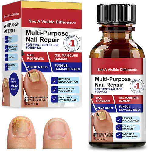 30ml nail treatment - 30ml, treatment,