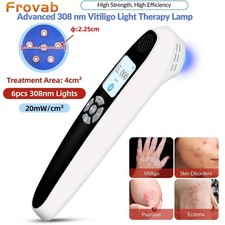 308nm Narrowband UVB