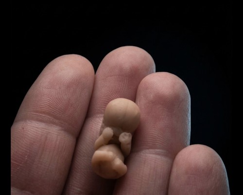 Micro clay embryo - x,