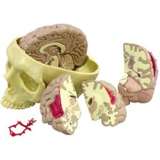 Brain Anatomical Model   GPI