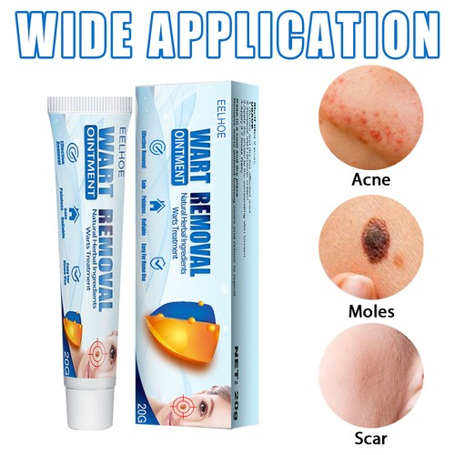 Skin tag removal warts remover - removal,