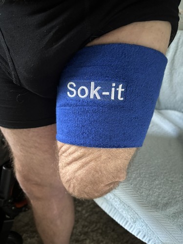 Above knee amputee - above,