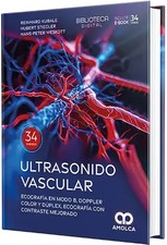 Ultrasonido vascular Ecografía en Modo B Doppler color y dúplex ecografía