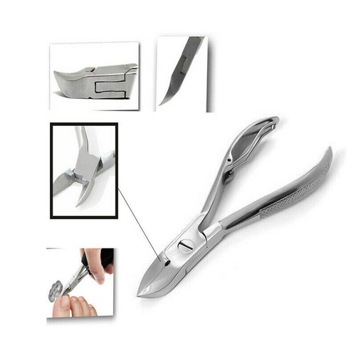 Chiropody toe nail - chiropody,