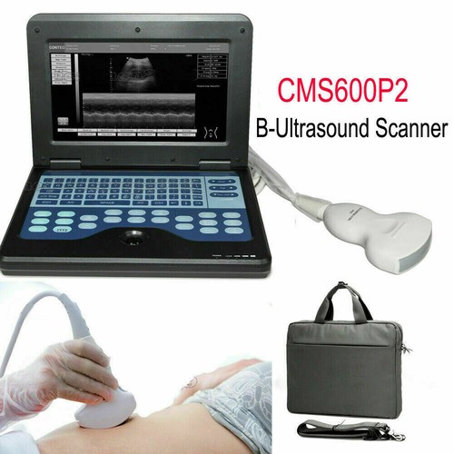 Cms600p2 portable ultrasound - cms600p2,