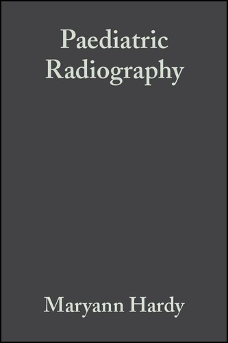 Paediatric radiography - paediatric,