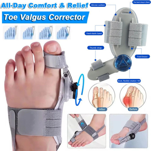 Nhs adjustable hallux - hallux, valgus