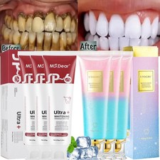 Niacinamide Whitening