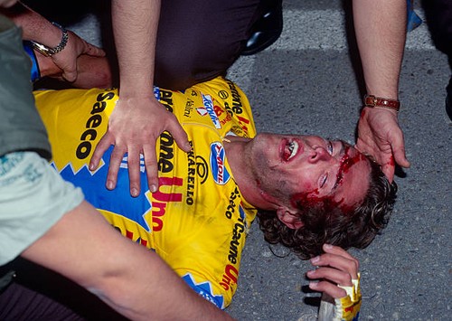 Mario cipollini after - cipollini, crash