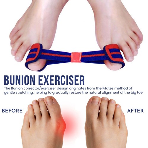 Bunion exerciser big feet - feet, toe