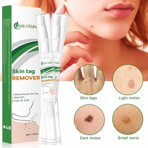 Skin tag wart mole - skin,