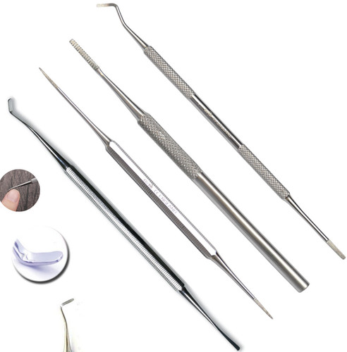 Ingrown toe nail - ingrown,