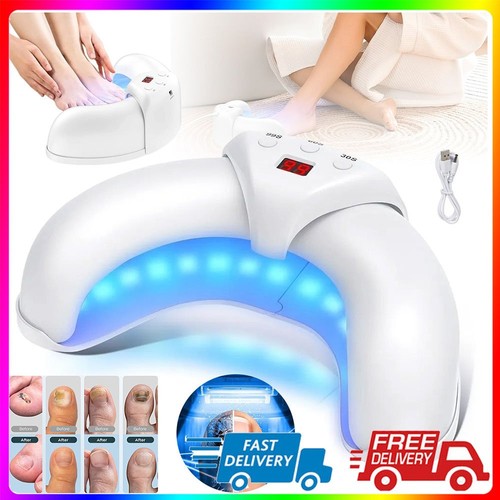 Toenail laser therapy - laser,