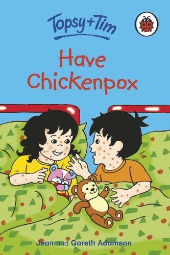 Topsy and tim have chickenpox - have,