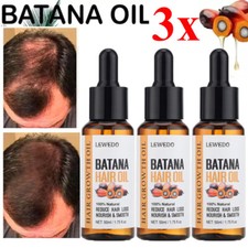 LEWEDO Batana Oil Serum For