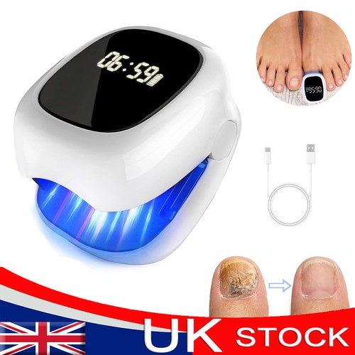Nail fungus laser - fungus, device