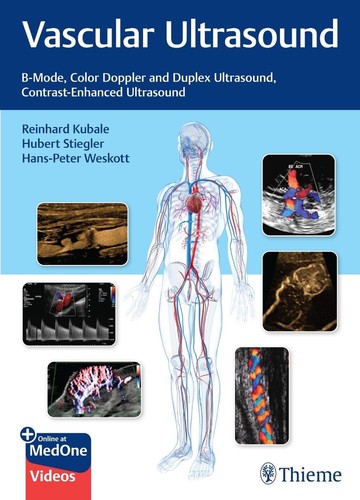 Vascular ultrasound mode - vascular, b-mode