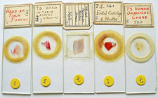 5 x  ANTIQUE HUMAN  EMBRYOLOGY  MICROSCOPE SLIDES,  FOETUS Sections etc.