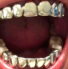 Silver Electroplated Non Tarnish Custom 8 Upper 8 Lower Grillz for Teeth + Molds