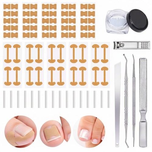 Ingrown toenail treatment tool - ingrown,
