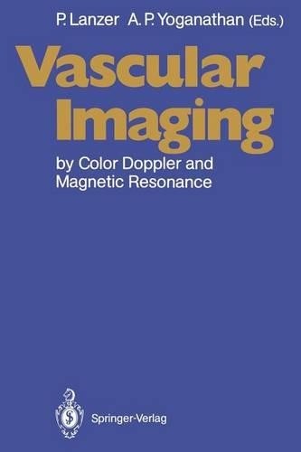 Vascular imaging color - vascular, by